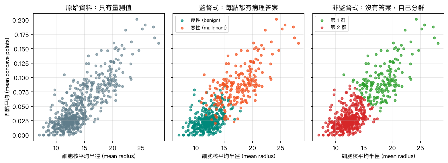 同一批乳癌資料：左圖只有量測值；中圖依病理答案上色（監督式）；右圖沒有答案、由演算法自己分成兩群（非監督式）