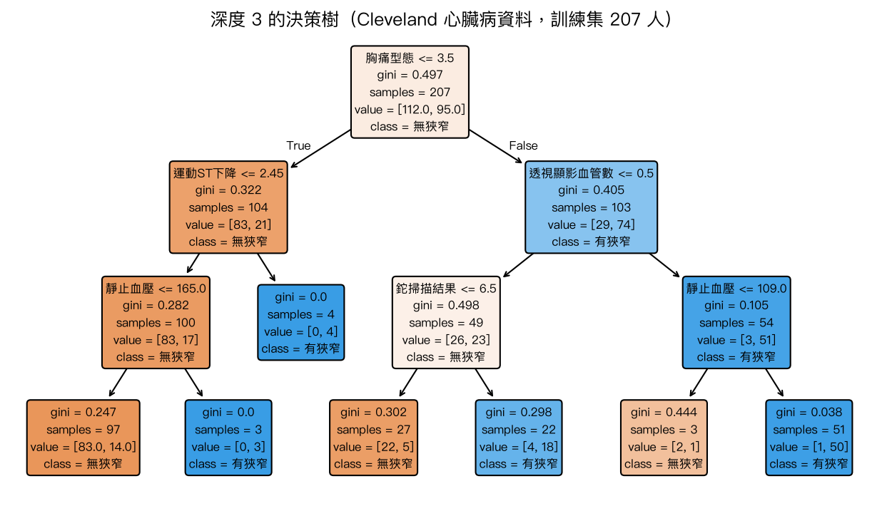 深度 3 的決策樹，根節點以胸痛型態切分