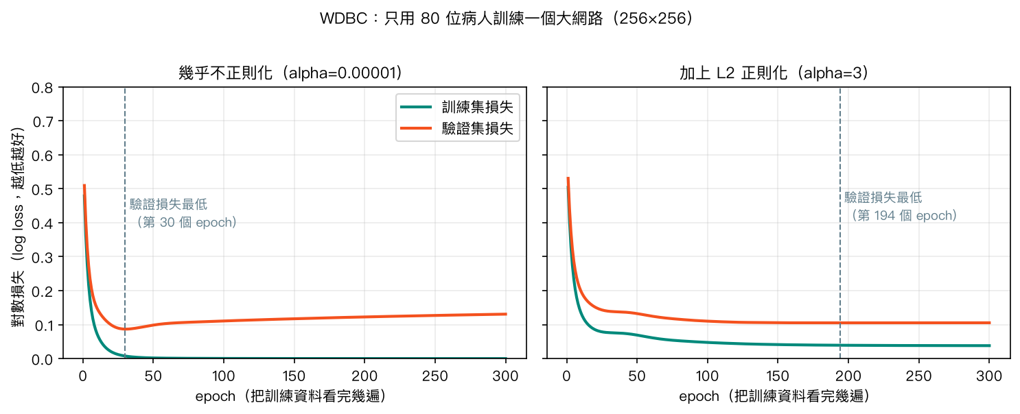 WDBC 只用 80 位病人訓練大網路：左圖幾乎不正則化，訓練損失降到接近 0，驗證損失在第 30 個 epoch 後回升；右圖加上 L2 正則化後，驗證損失不再回升