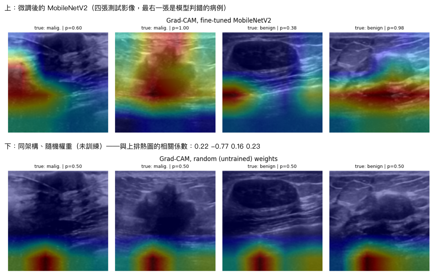 上排：微調後模型對四張測試影像的 Grad-CAM 熱圖；下排：同架構隨機權重模型的熱圖，四張都集中在影像下方中央